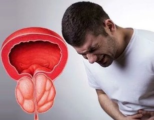 Simptomai lėtinės prostatitas vyrų